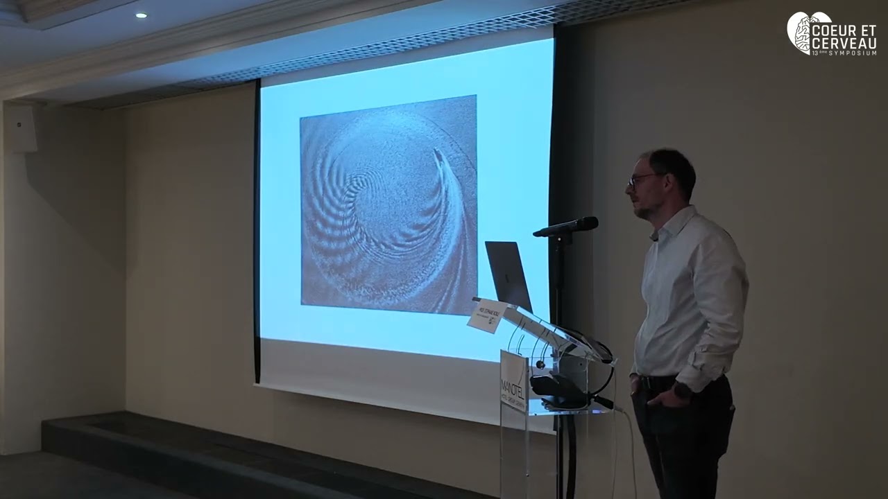 Prof. Stéphane Noble - Thrombus en transit dans l’oreillette droite et aspiration de végétation