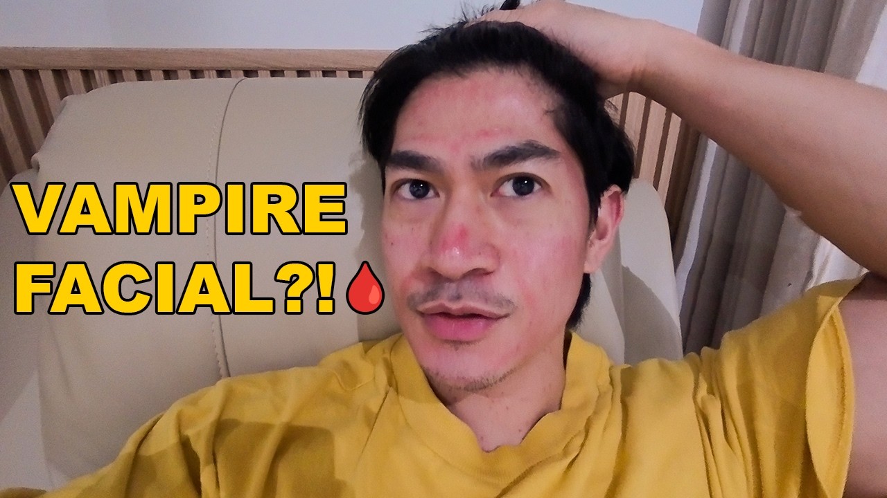 I Got a Vampire Facial for Christmas