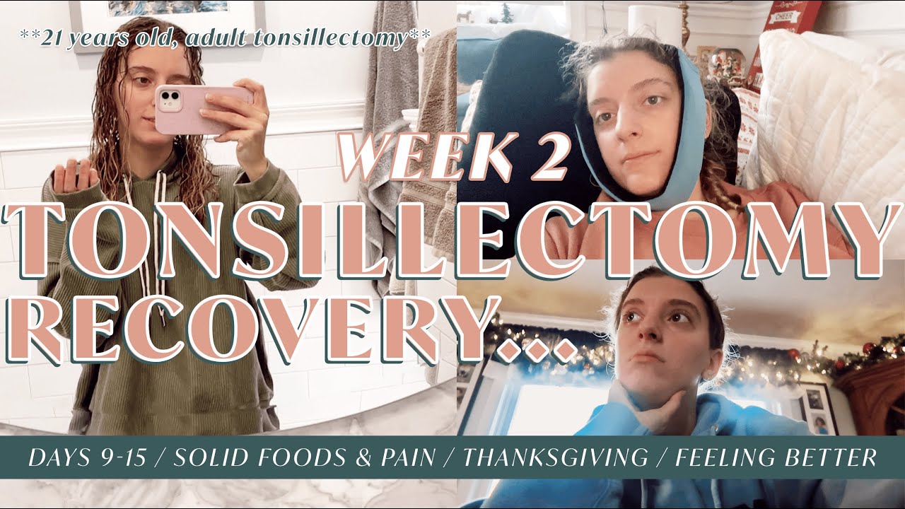 ADULT TONSILLECTOMY | RECOVERY DAYS 9-15, soft foods, feeling better, Thanksgiving & more! *REAL*
