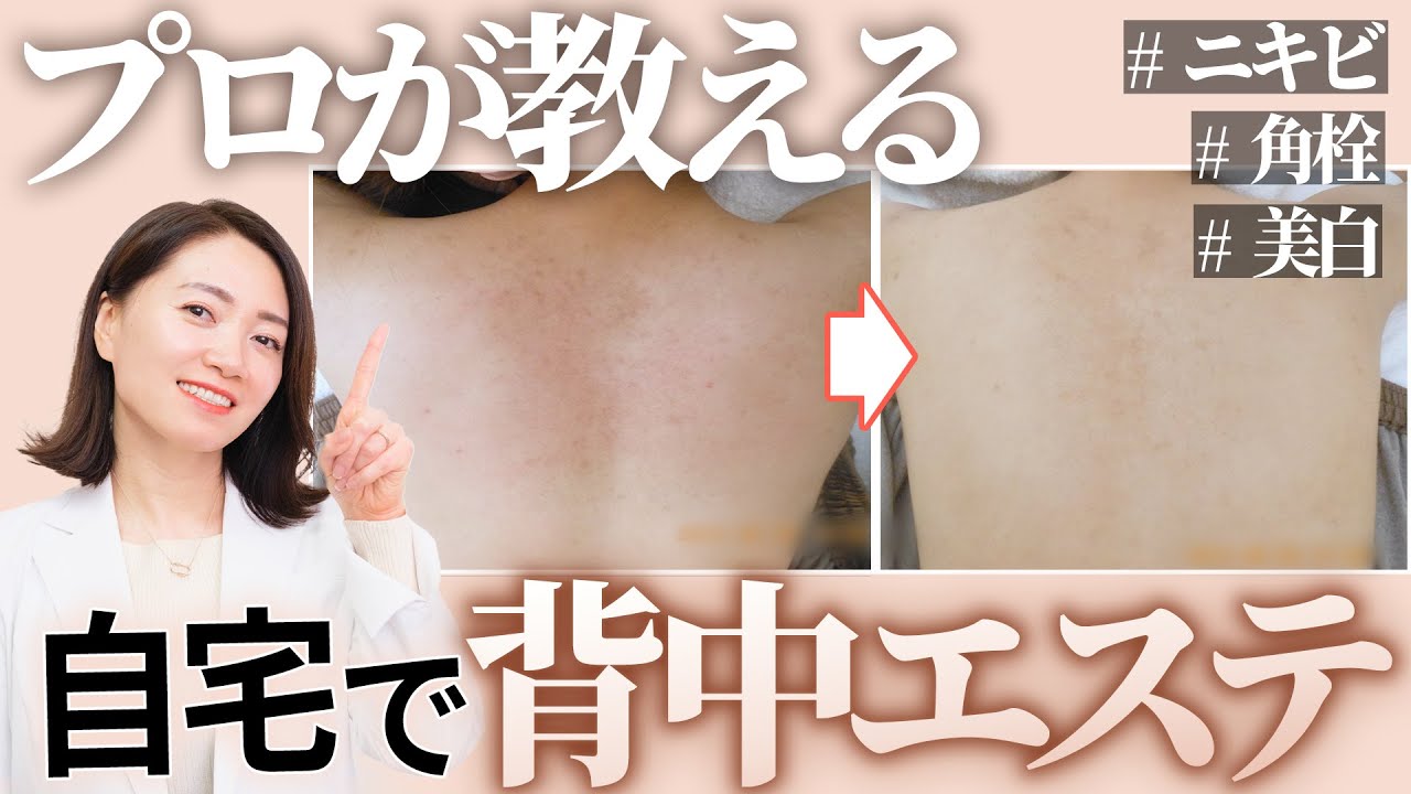 【プロ回答】背中ケアの質問まとめ&私が勧めてるアイテム