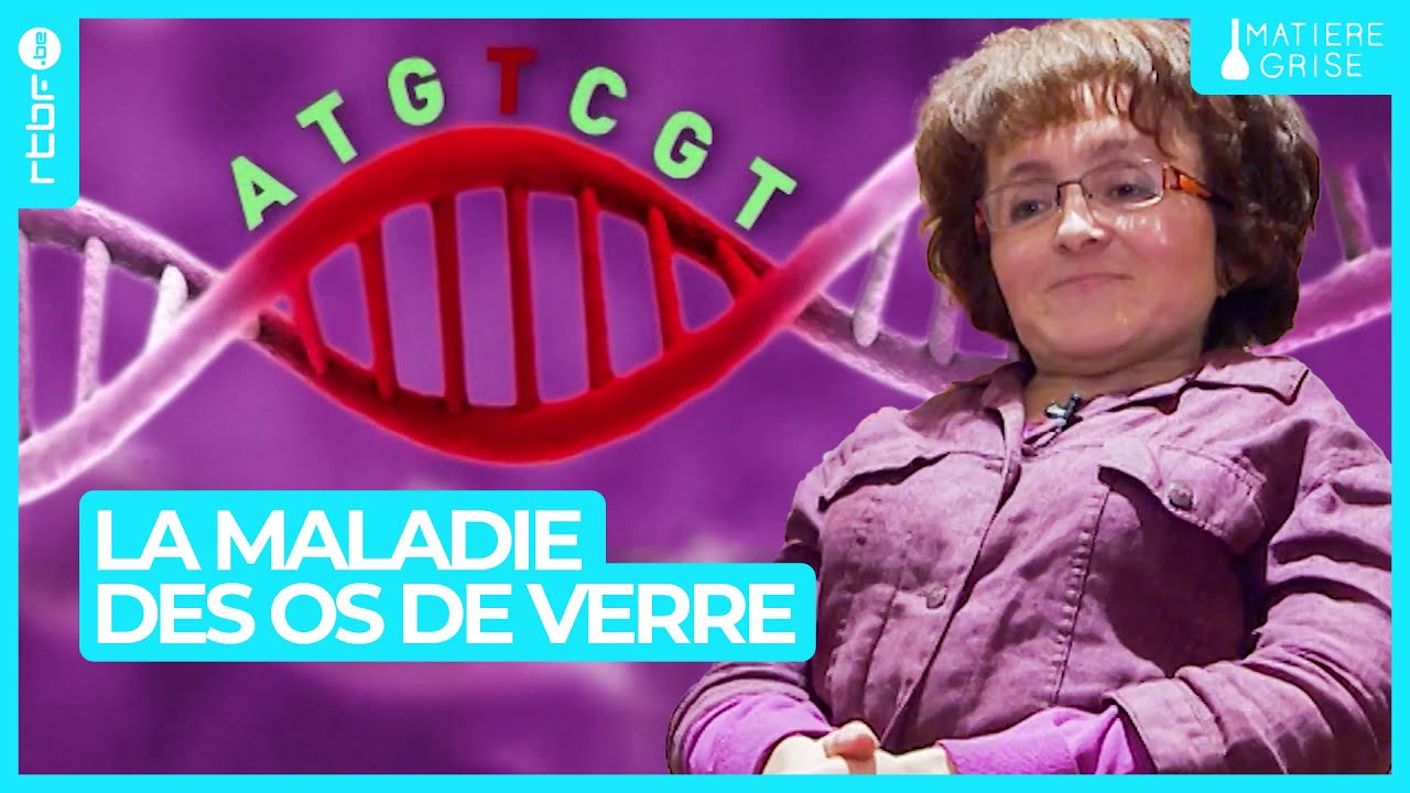 Os de verre : cette maladie génétique qui rend votre squelette fragile - Matière Grise