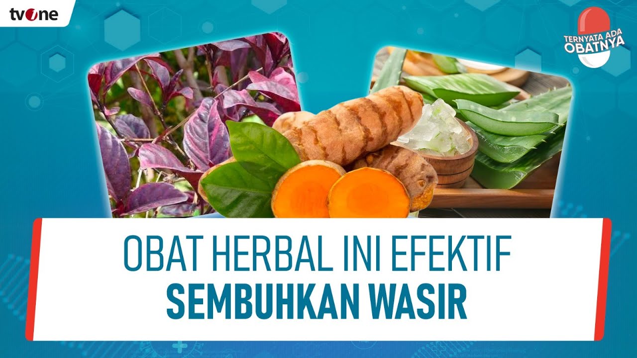 Obat Alami Atasi Wasir Ini Bisa Dicoba di Rumah Tanpa Perlu Operasi