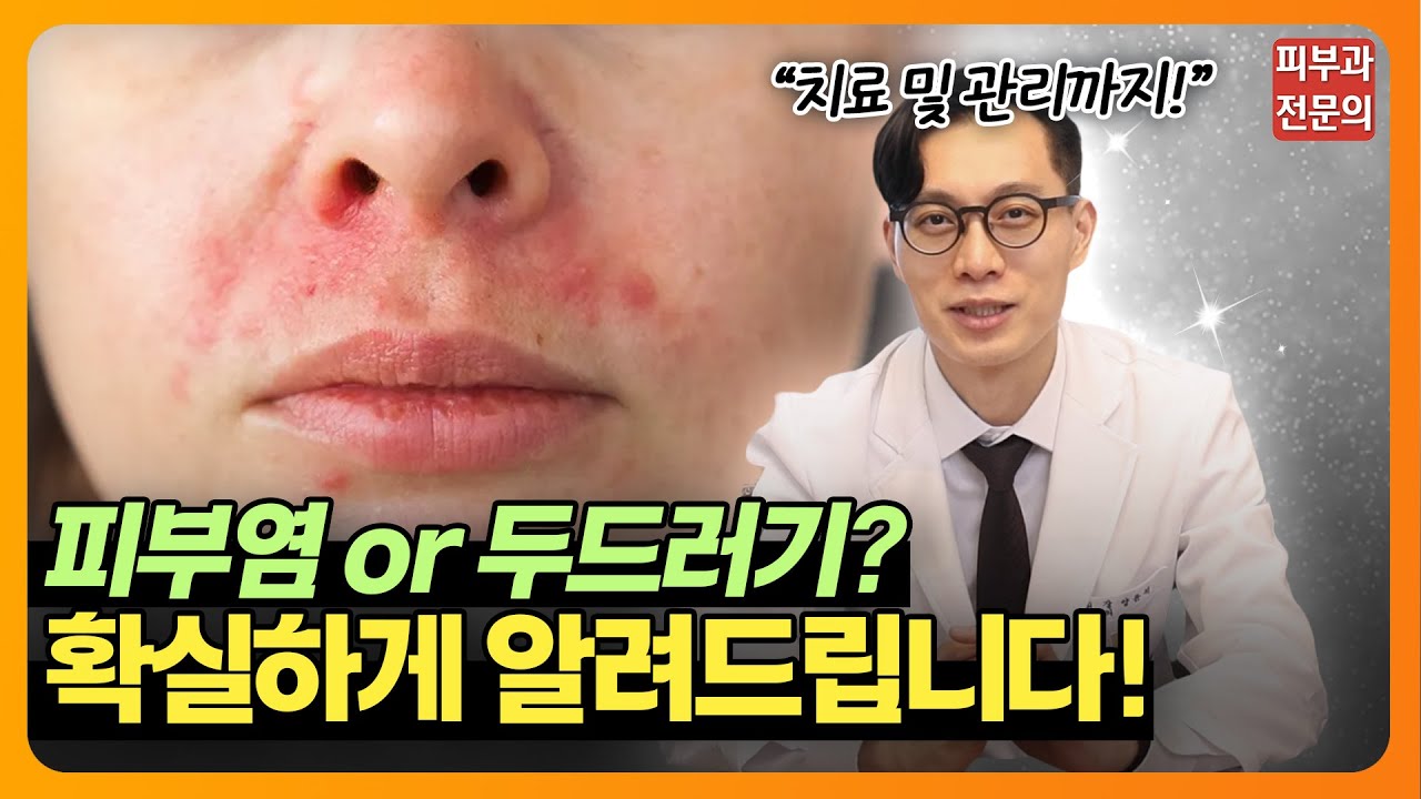 피부염&두드러기? 이렇게 구분하고 관리하세요!👀 | 피부염,두드러기,피부질환