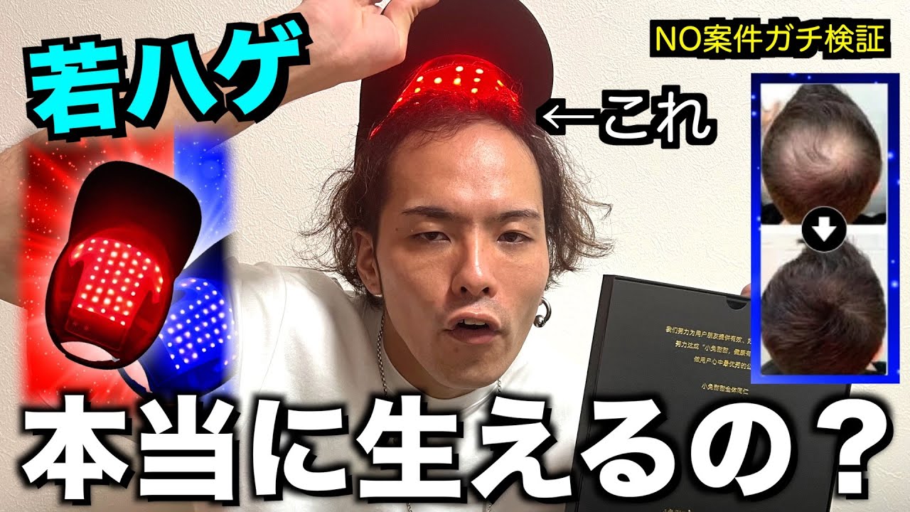 【検証】若ハゲを育毛LEDキャップは救えるのか？