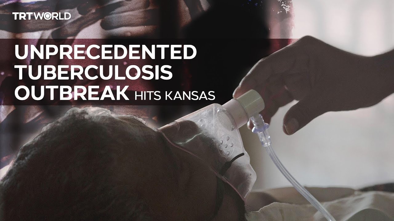 Kansas facing one of the worst tuberculosis outbreaks in US history