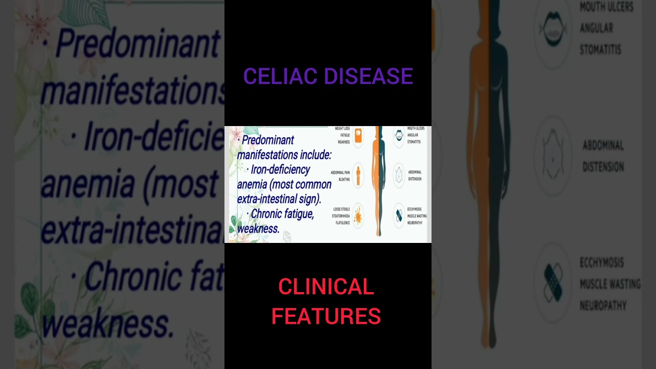 CELIAC DISEASE: CLINICAL FEATURES 