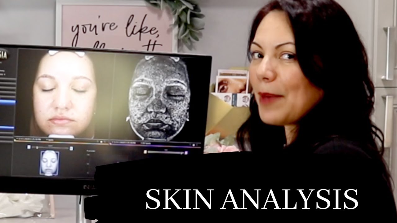 Skin Analysis