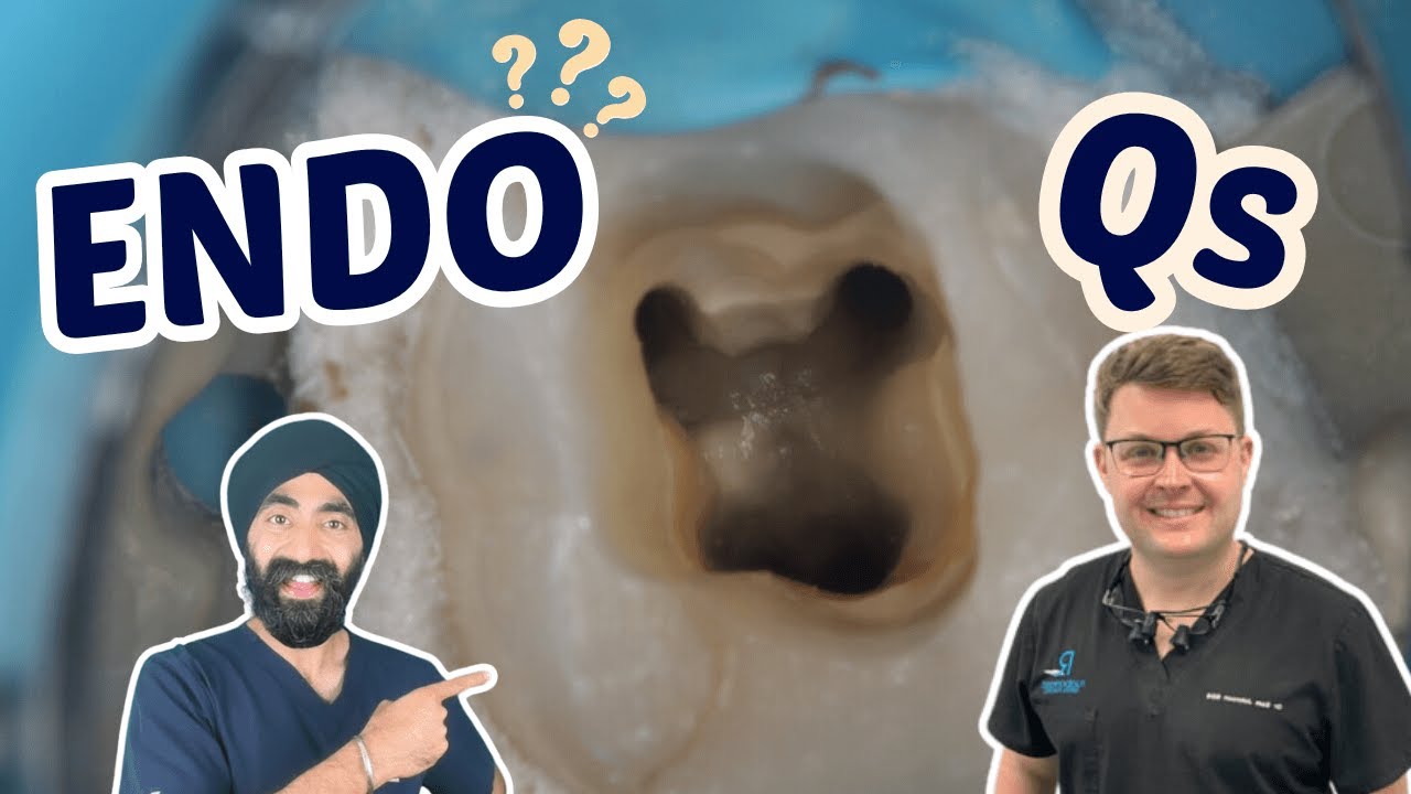 Your Endodontics Questions Answered! - PDP217