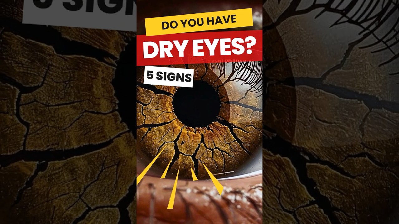 Dry Eyes WARNING Signs Most People Miss!
