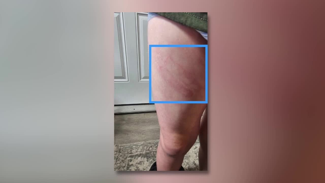 VB mother says son with special needs came home with injury caused by adult