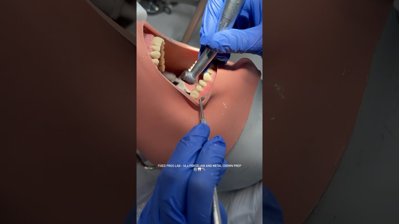 Fixed Pros Lab 🦷 #dentistry #dentalstudent #dental #dentalschool #dentist #london #university #vlog