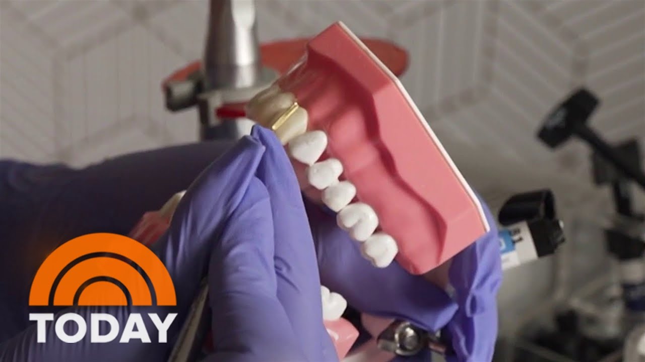 What to know about social media ads promising the perfect smile