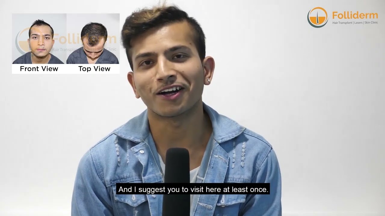 Mr. Niraj Khadka's Hair Transplant Story | Hair Transplant in Nepal