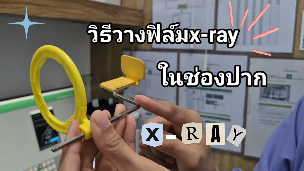 วิธีวางฟิล์มx-rayในช่องปาก #xrayซี่ฟัน #ผู้ช่วยทันตแพทย์ #xcp