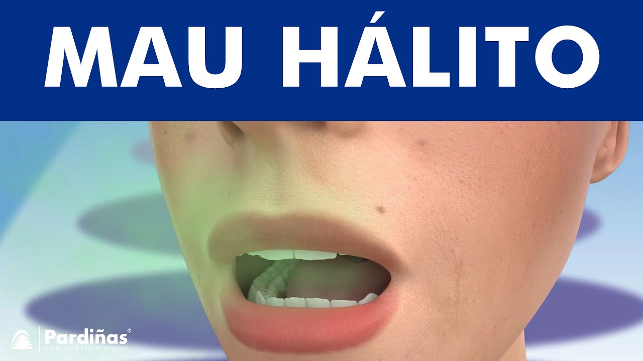 Halitose - Mau hálito ©