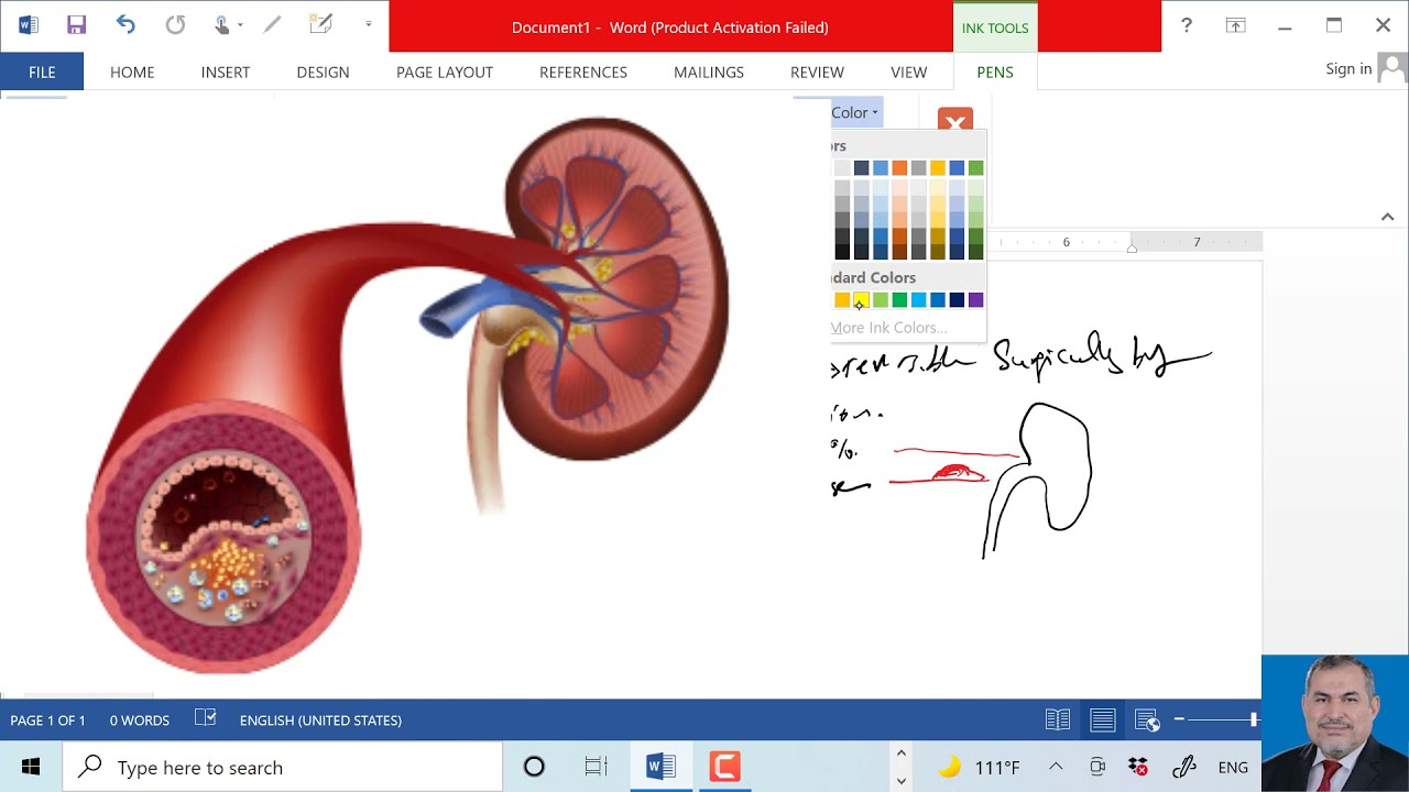 urology   renal artery stenosis د عامر الخزاعي