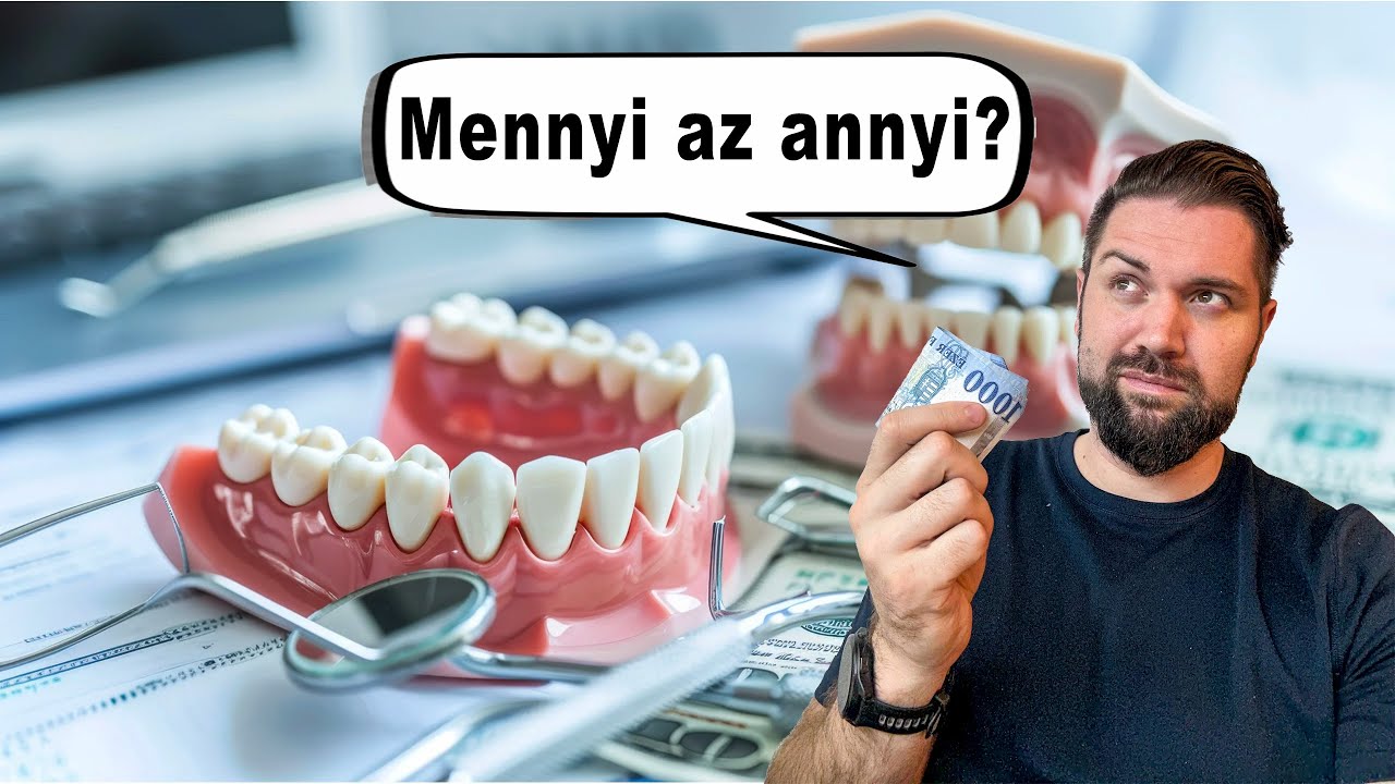 Hogyan működik egy átlagos fogászati árlista?