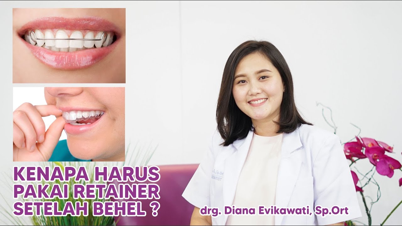 RETAINER GIGI Perawatan Wajib Setelah Perawatan Behel