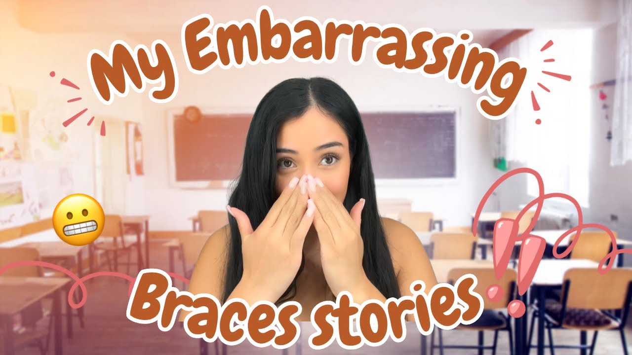 My Embarrassing Braces stories 😬 || #braces #embarrassingstories #bracesupdate