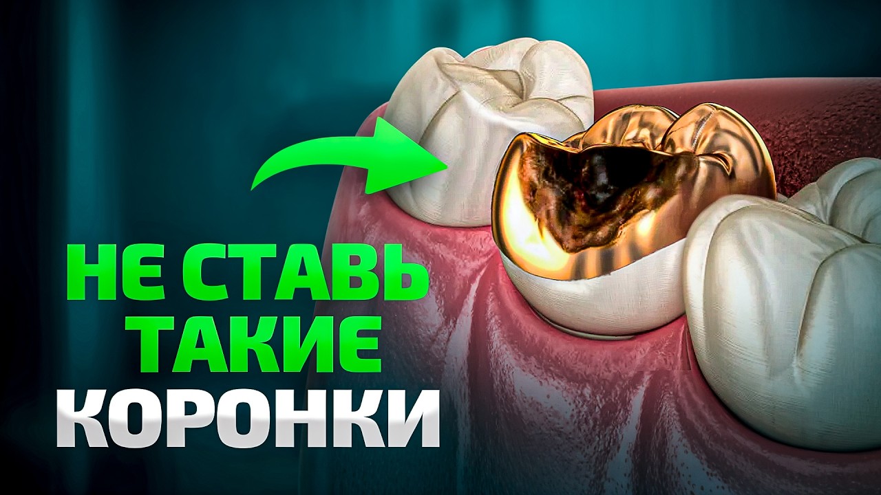 Какие КОРОНКИ выбрать в 2025 году? Подробный гайд от главного ортопеда