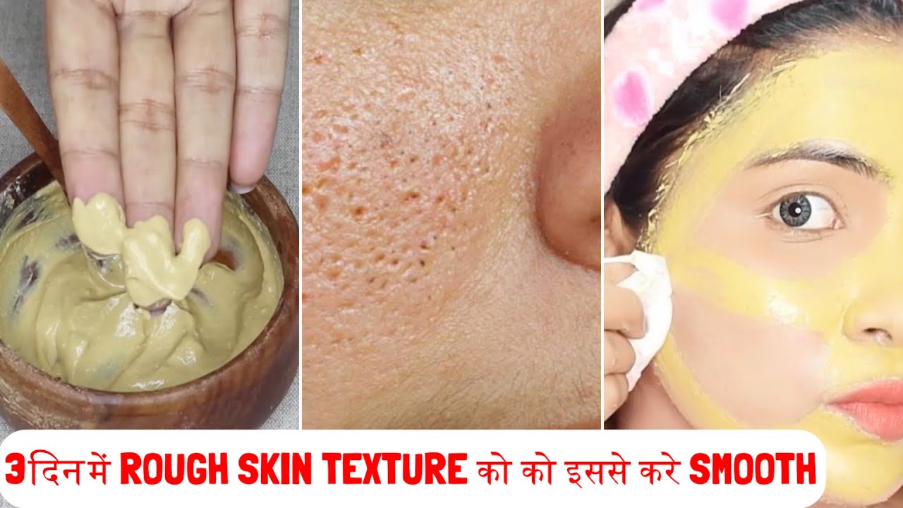 सिर्फ 3 Use-Large Open Pores Will disappear from Your skin forever- Rough Skin Texture करे को Smooth