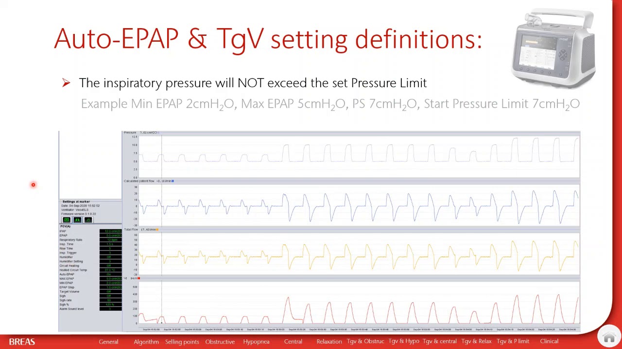 The Breas Auto-EPAP algorithm