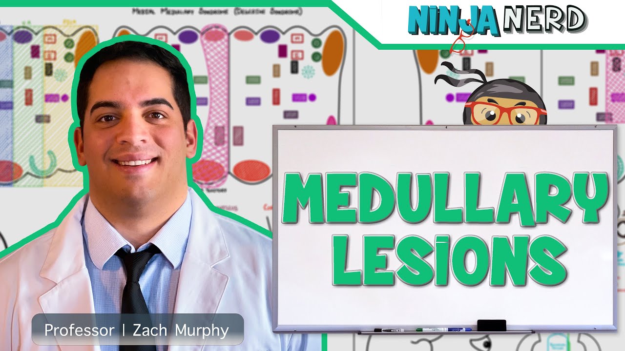 Medullary Lesions: Medial and Lateral Medullary Syndromes