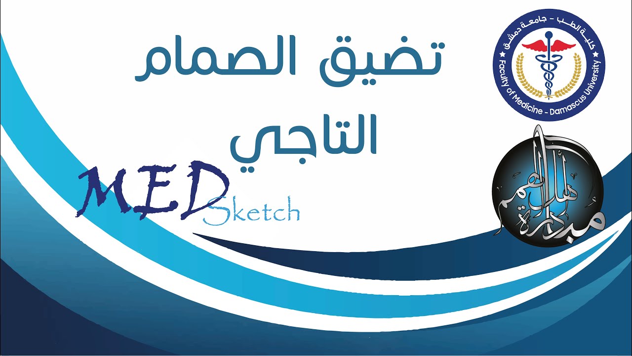 تضيق الصمام التاجي Mitral stenosis _ جامعة دمشق كلية الطب البشري