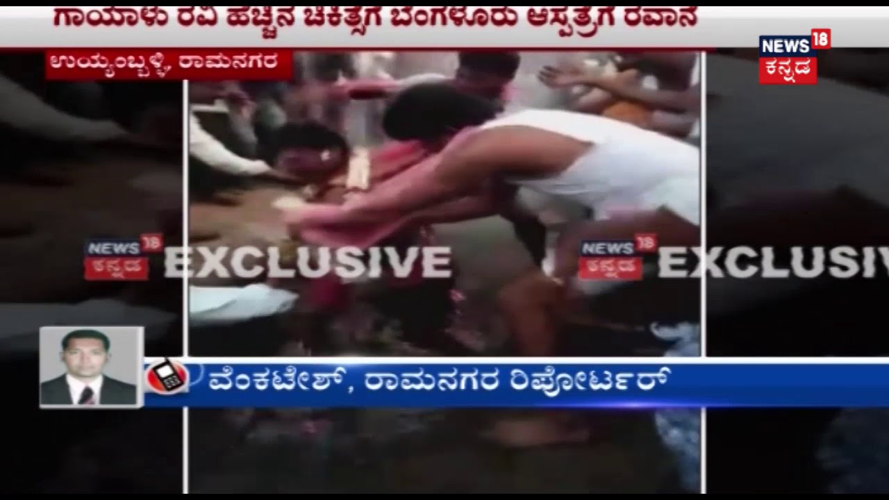 Ramnagar: Temple Priest Falls Into Burning Coal While Performing Fire Walk Ritual