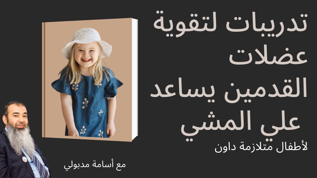 هل تبحث عن طرق لتحسين مشي طفلك ؟ إليك الحل! : تمارين تقوية القدمين المصممة خصيصًا ل #متلازمة_داون