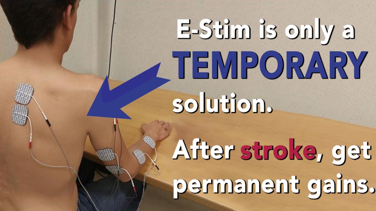 Why doesn't Motus Nova use E-Stim? | Does it work?