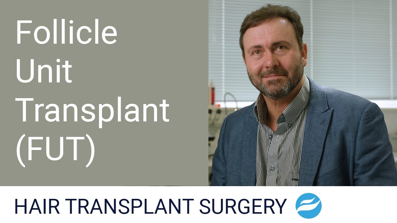Follicle Unit Transplant - FUT - Dr. Andr&eacute; Nel - Hair Restoration Clinic