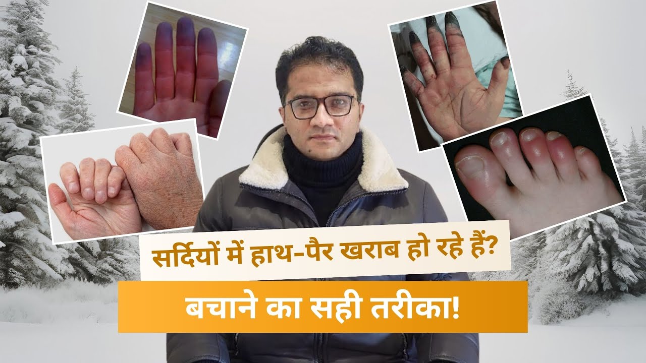 सर्दियों में हाथ-पैर खराब हो रहे हैं? बचाने का सही तरीका!