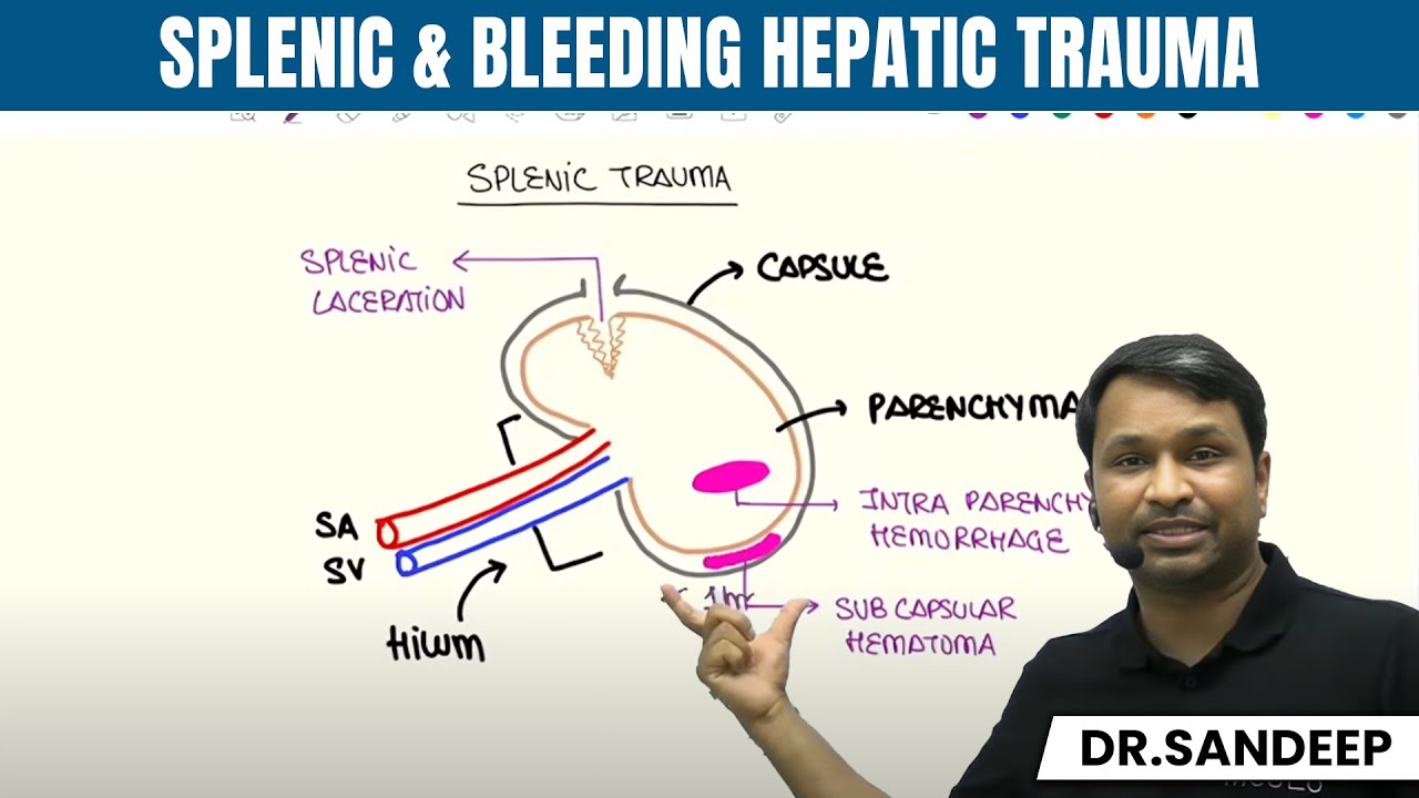 Splenic & Bleeding Hepatic Trauma | Surgery | Bailey learned with Dr. Sandeep | PW MedEd