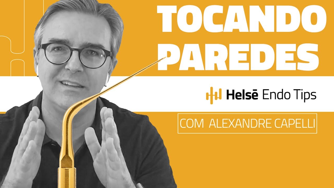 TOCANDO MAIS PAREDES DO SISTEMA DE CANAIS RADICULARES - ENDO TIPS