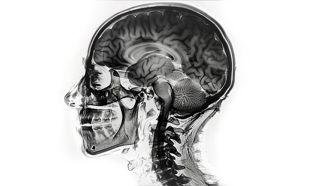 This Video Is About BRAINROT