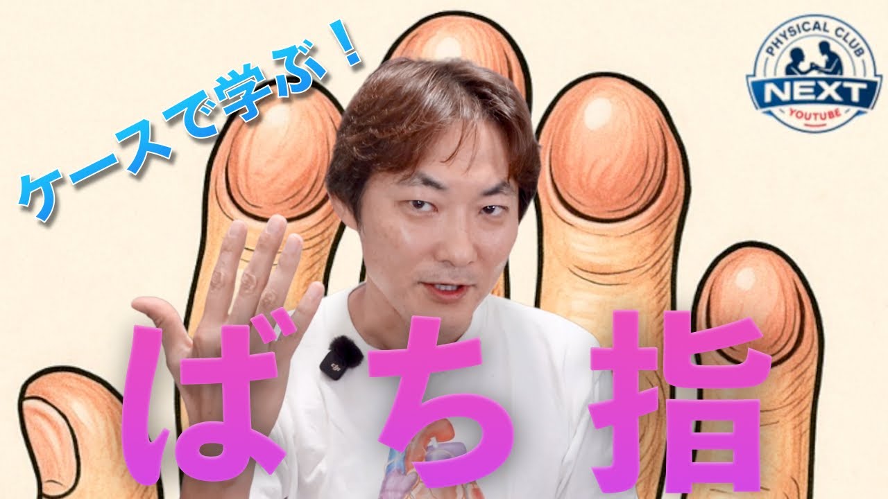 ケースで学ぶ！“ばち指のサイン”Learning from Cases: The Signs of Clubbing（症例編）