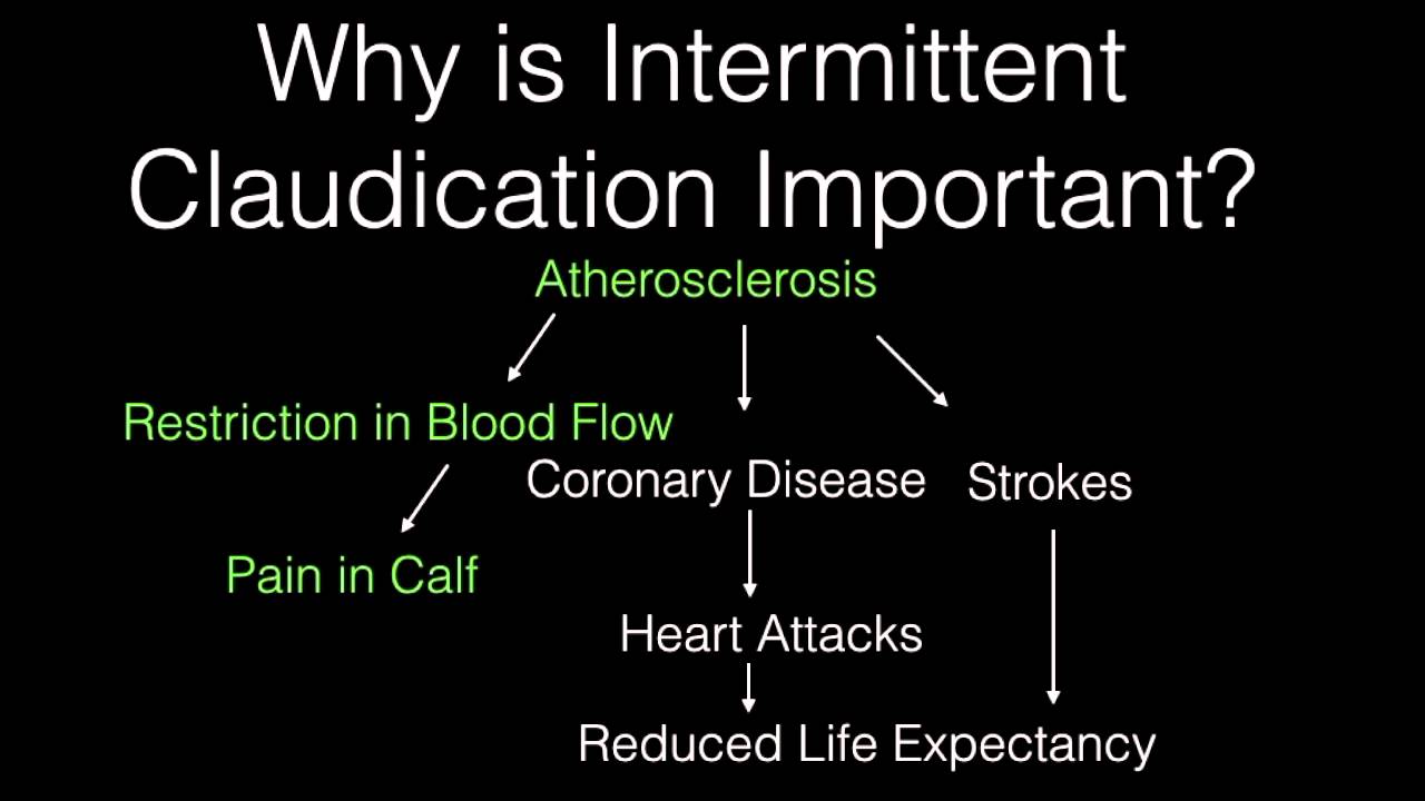 Intermittent Claudication of the Leg: A Threat to Your Health