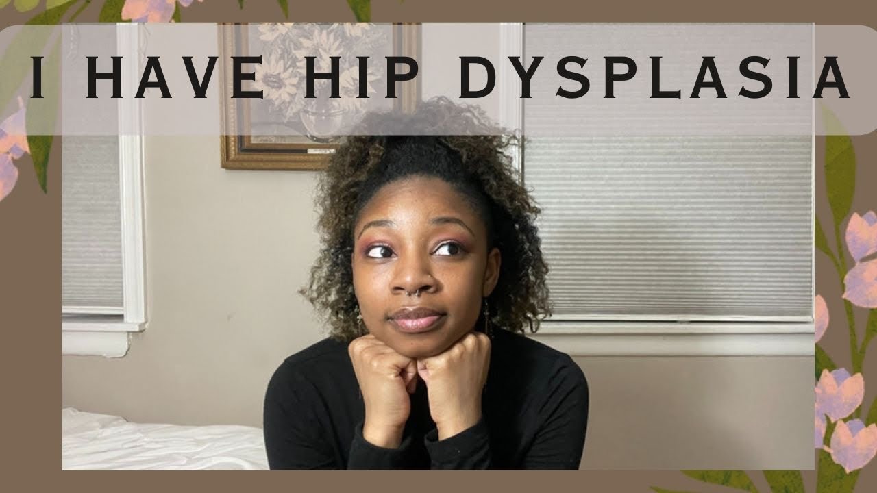 I HAVE HIP DYSPLASIA | My Diagnosis Story