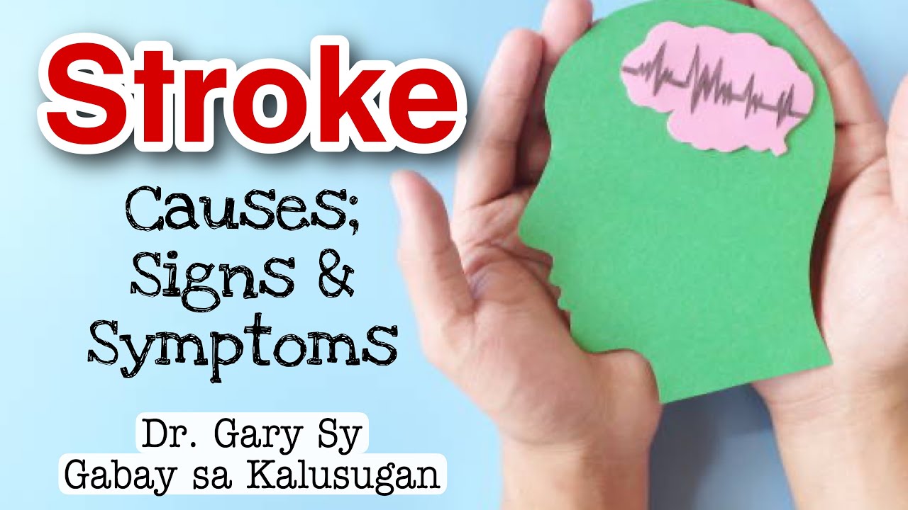 Stroke - Causes, Signs & Symptoms - Dr. Gary Sy