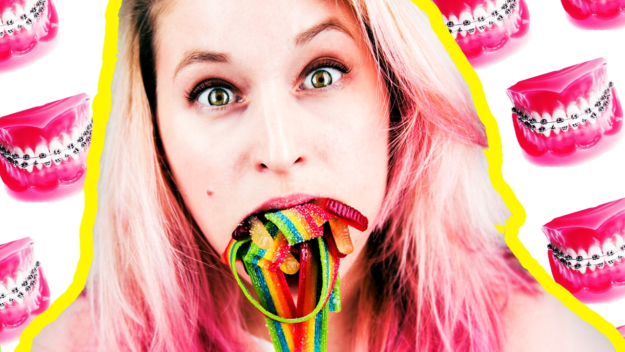 12 Things People With Braces Can't Eat