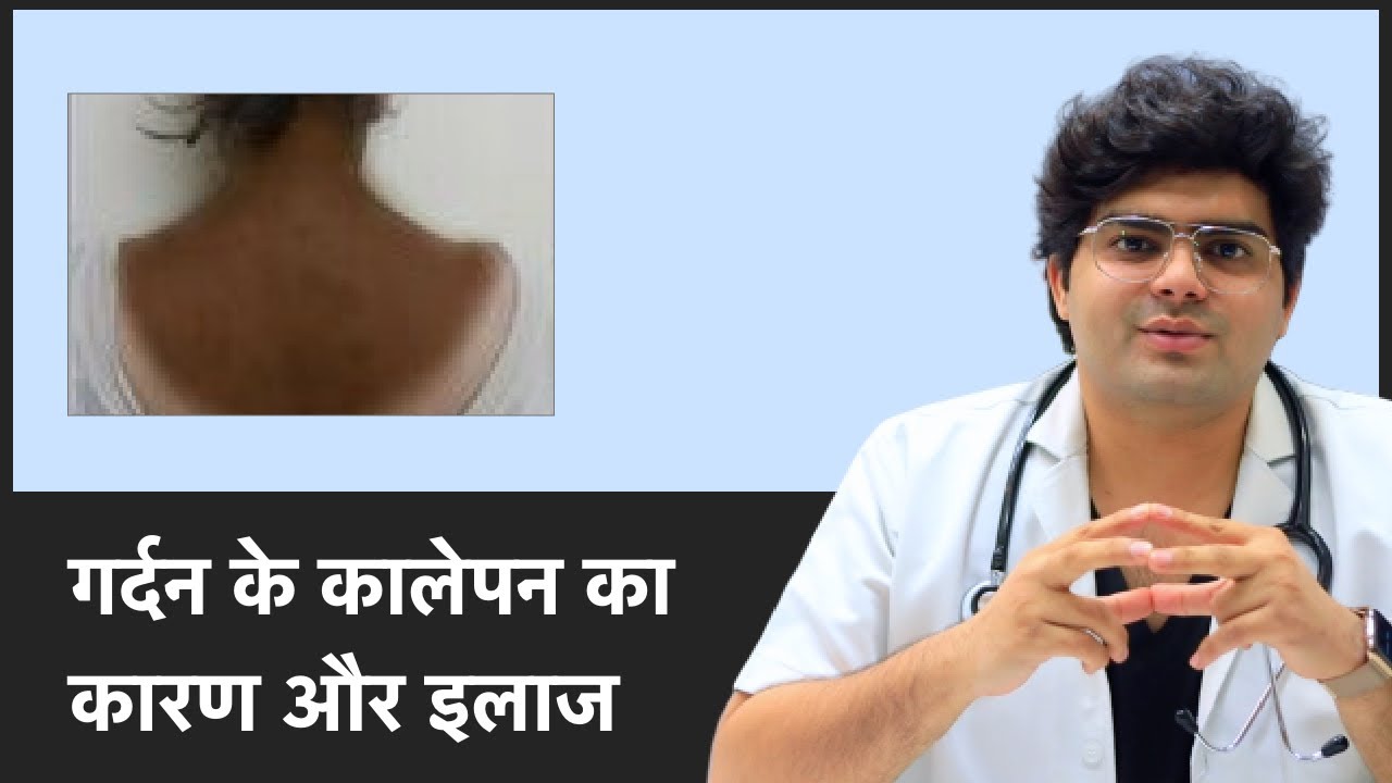Reasons and Cure For Dark Neck | जानिए कारण और इलाज For Dark Neck | Clear Skin, Pune