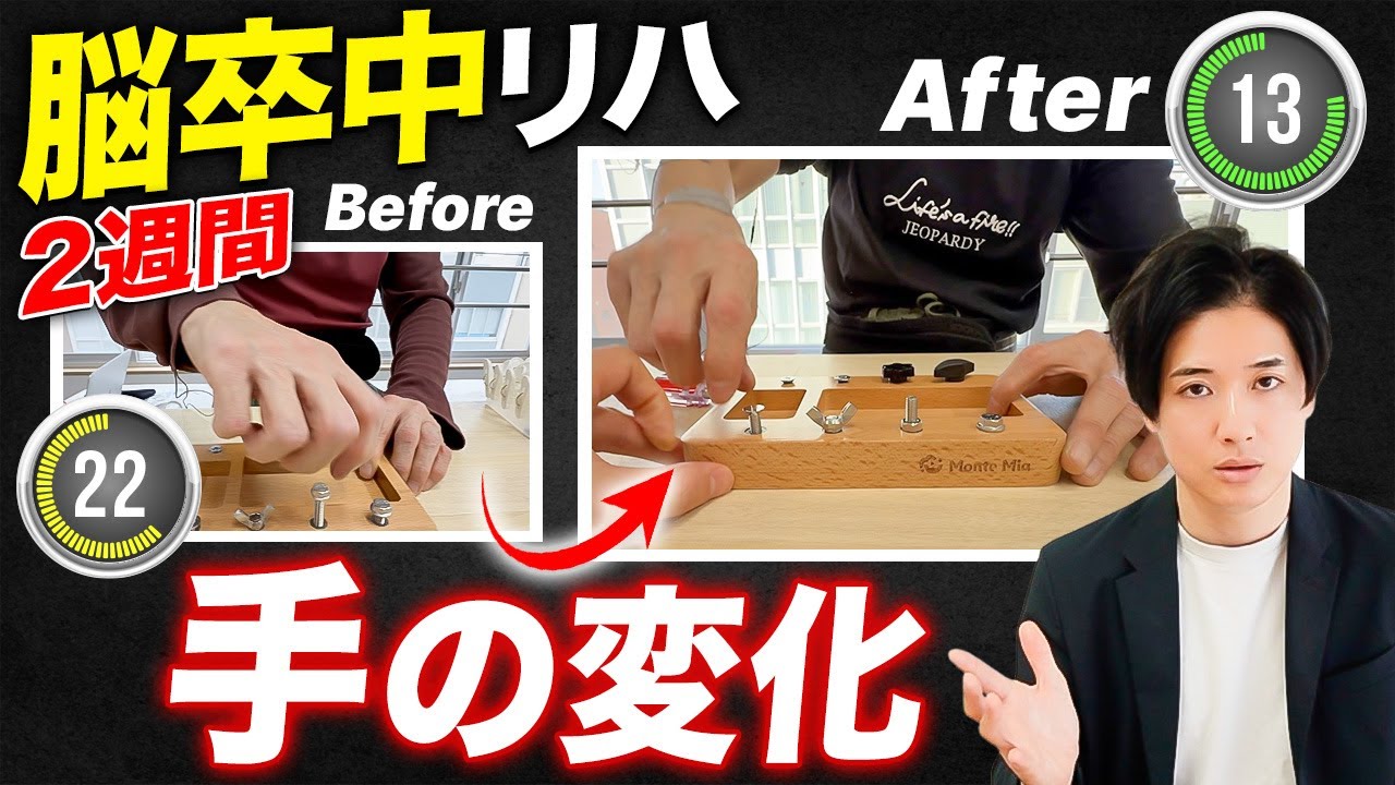 【脳卒中】2週間で“指の速さと精度”はどれくらい変わる？｜脳出血・手の変化 Before→After