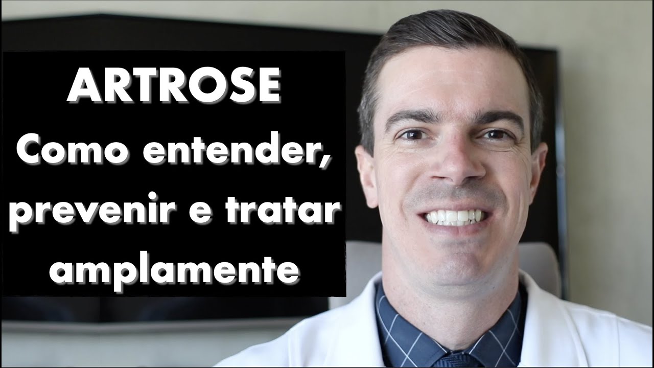 ARTROSE: como Entender, Prevenir e Tratar Amplamente