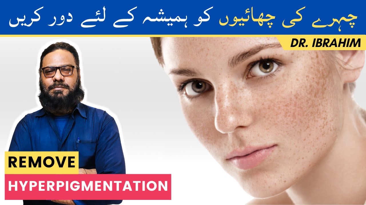 Face/Chehre Ki Chaiyan Khatam Karen Ka Tarika | Remove Hyperpigmentation, Wrinkles, Dark Spots