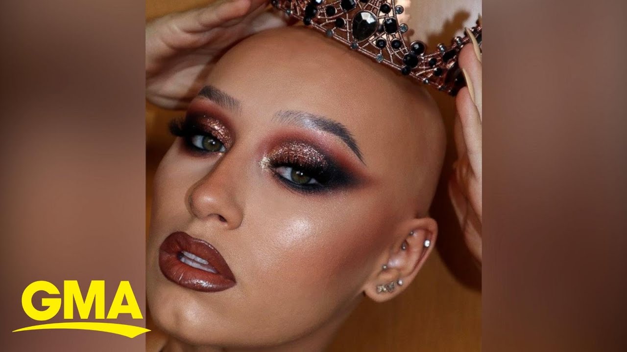 Influencer with alopecia gets 'unready' in videos to redefine beauty standards l GMA