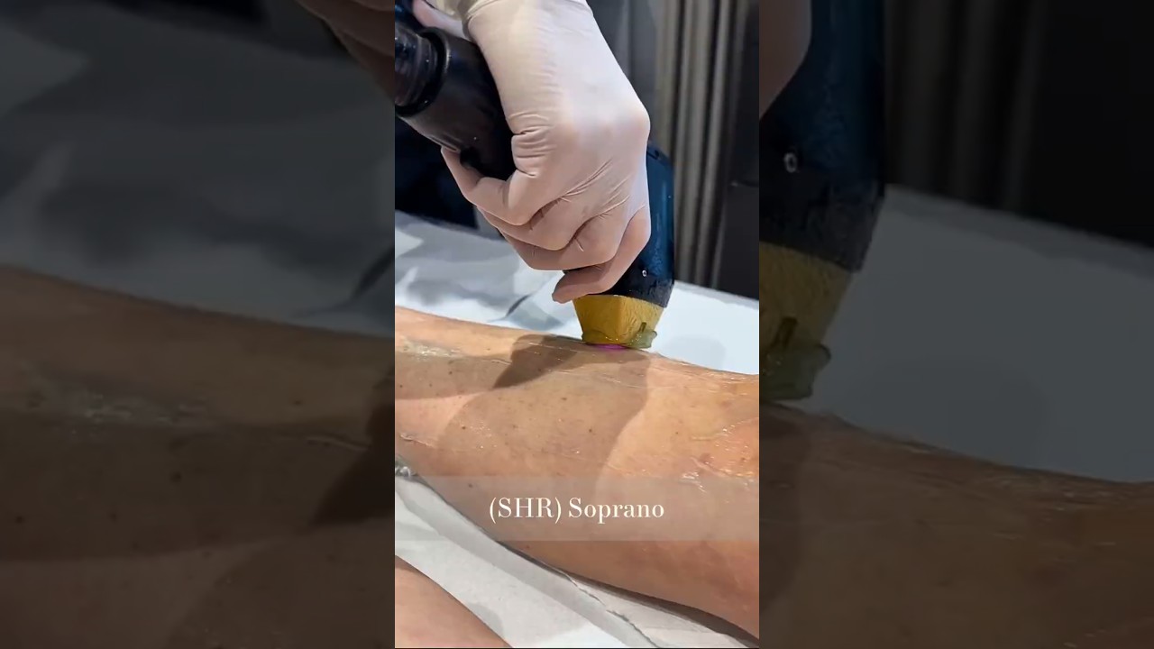 SHR