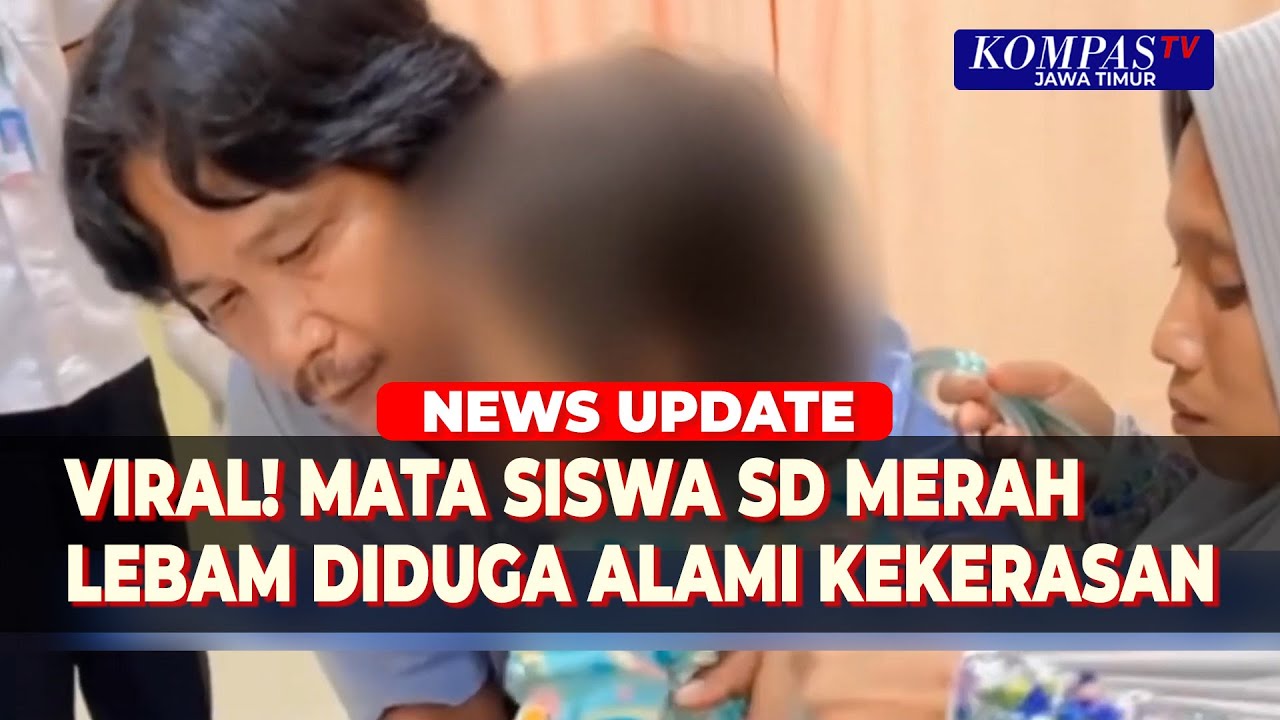 Viral! Mata Siswa SD Merah-Lebam Diduga Alami Kekerasan, PPA Palembang Turun Tangan Dampingi Korban