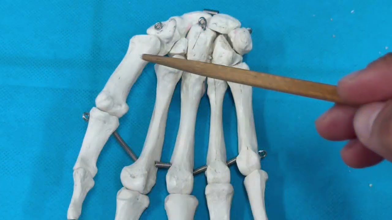 ANATOMIE FMPM - OSTEOLOGIE DE LA MAIN