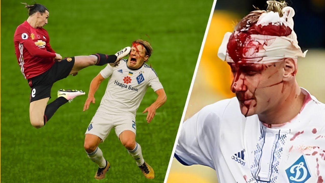 When a Single Foul Ended a Career | Football’s Darkest Moments